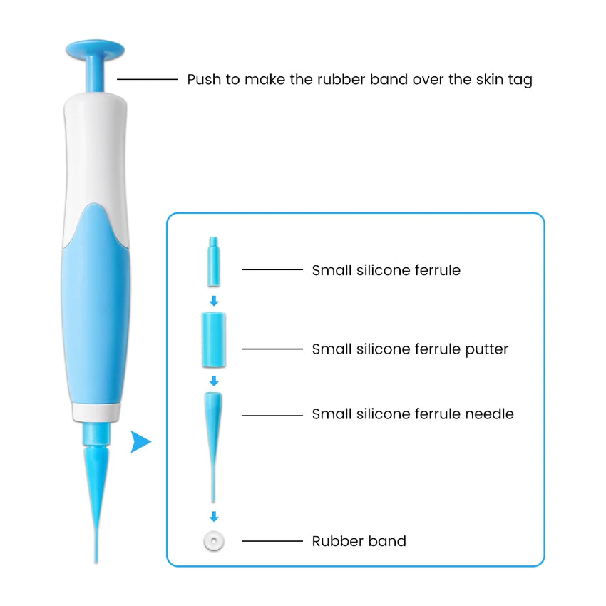 Auto Skin Tag Removal Tool Kit Painless Skin Label Mole Acne Wart Removal Pen with Cleansing Swabs Facial Skin Care Beauty Tool