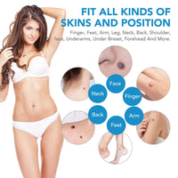 Auto Skin Tag Removal Tool Kit Painless Skin Label Mole Acne Wart Removal Pen with Cleansing Swabs Facial Skin Care Beauty Tool