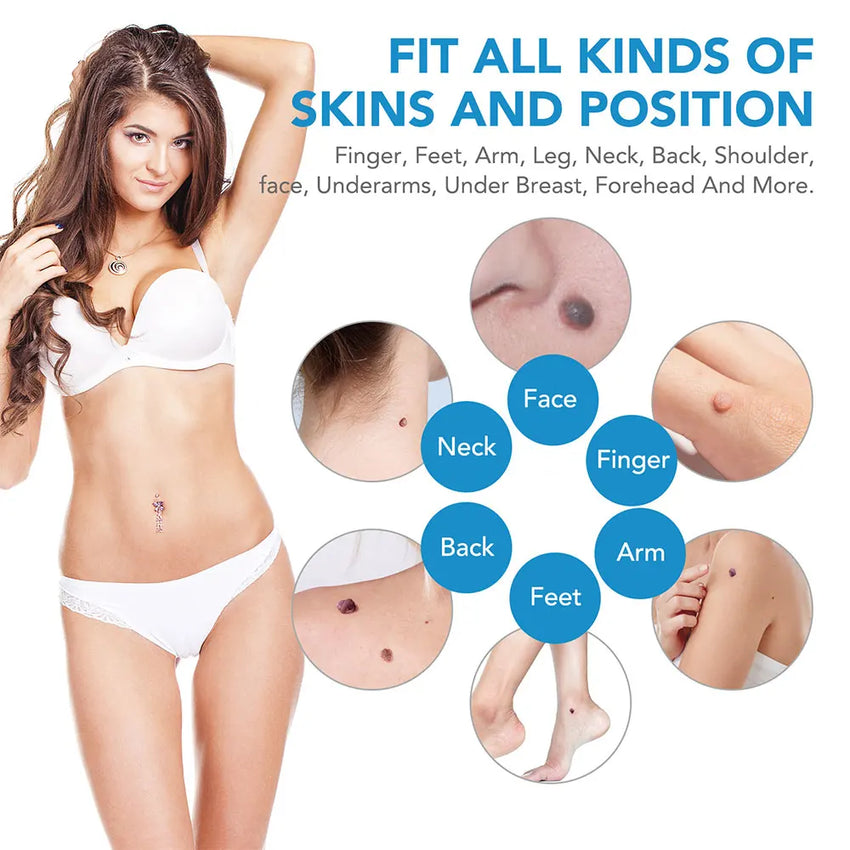 Auto Skin Tag Removal Tool Kit Painless Skin Label Mole Acne Wart Removal Pen with Cleansing Swabs Facial Skin Care Beauty Tool