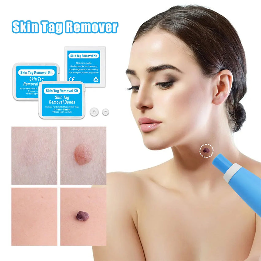 Auto Skin Tag Removal Tool Kit Painless Skin Label Mole Acne Wart Removal Pen with Cleansing Swabs Facial Skin Care Beauty Tool
