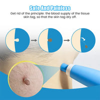 Auto Skin Tag Removal Tool Kit Painless Skin Label Mole Acne Wart Removal Pen with Cleansing Swabs Facial Skin Care Beauty Tool